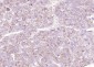 VEGFR1 Rabbit pAb